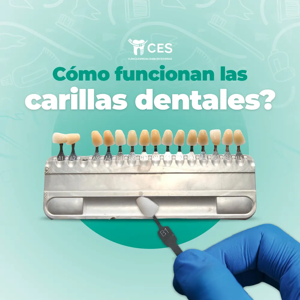 Pieza para Clínica de Sonrisas