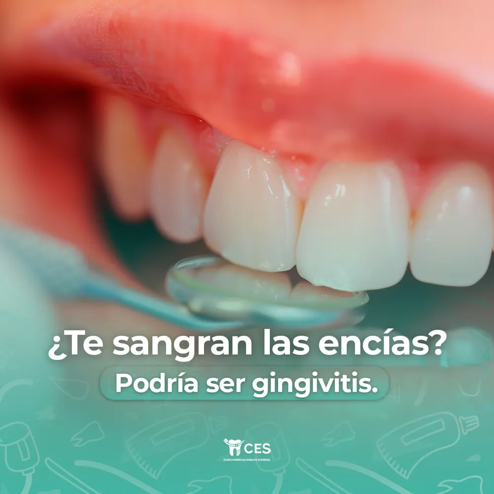 Pieza para Clínica de Sonrisas